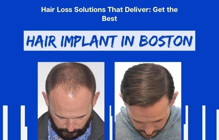 Hair-Loss-Solutions-That-Deliver-Get-the-Best-Hair-Implant-in-Boston