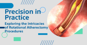 Rotational Atherectomy